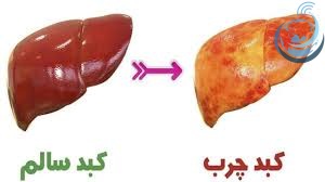 تصویر کبد چرب و کبد سالم